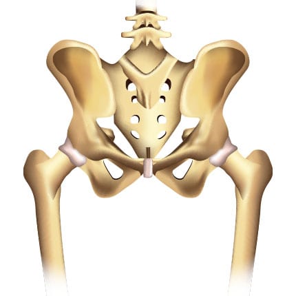 Hip Replacement Arthroplasty|Hip Replacement Arthroplasty|